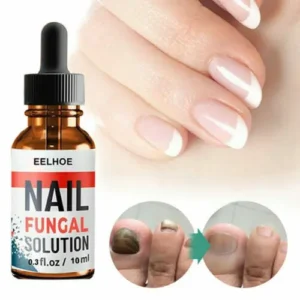 Sickle Pyrox Nail Lacquer Med: Nightmare for  Nail Fungus